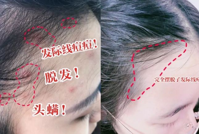 干好？10分钟轻松养成女明星「绸缎发」MG不朽情缘正版洗完头自然风干还是吹(图20)